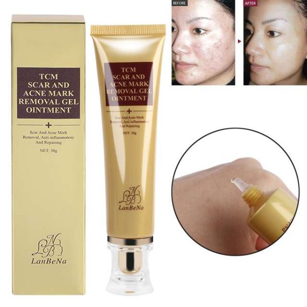 TCM scar removal cream